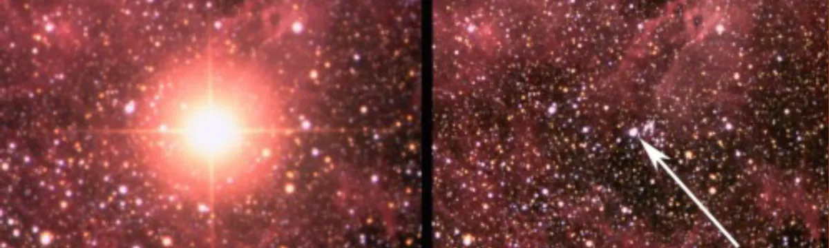 SN1987A